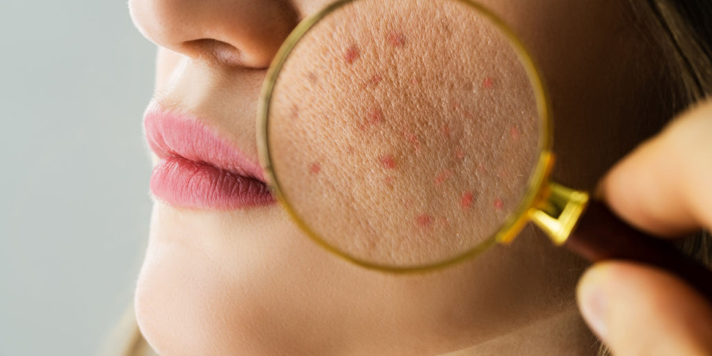 How to Repair a Damaged Skin Barrier: Step-by-Step